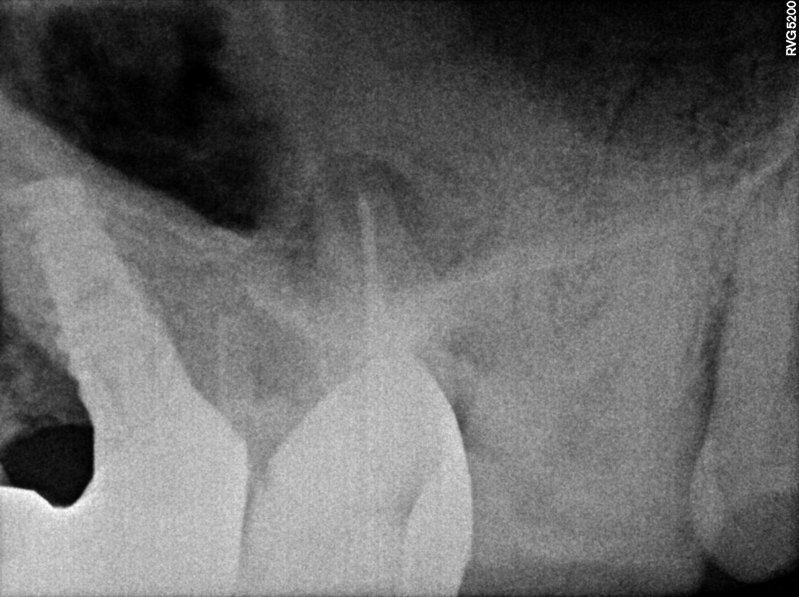 Dental X-ray